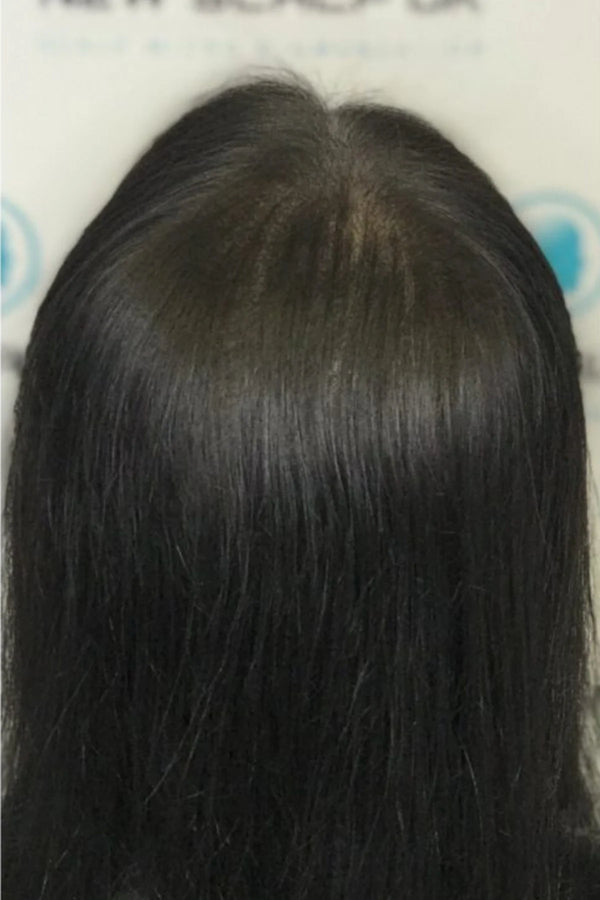 After