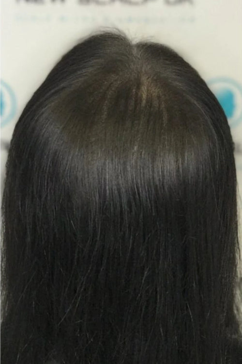 After