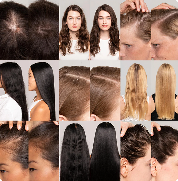 Join 200,000+ Who Have Reached Their Hair Goals