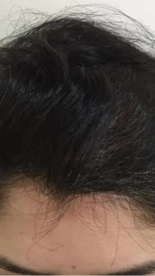 After