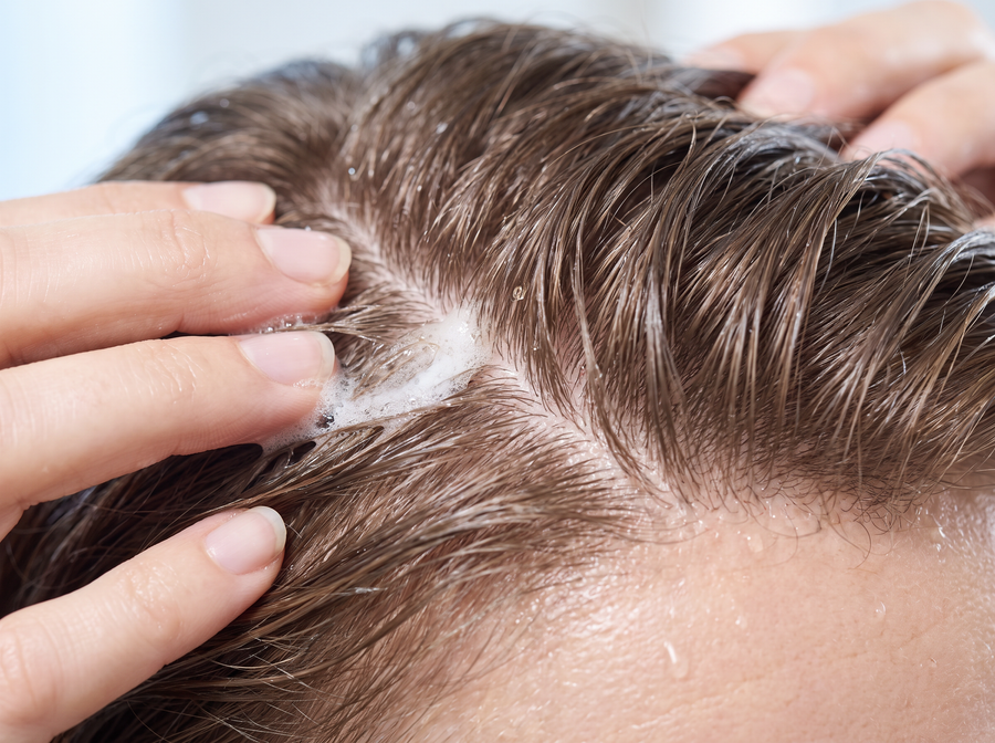 Lather being worked into the scalp